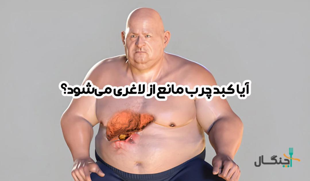 ایا کبد چرب مانع از لاغری میشود؟ پاسخ علمی به یک سوال پرتکرار