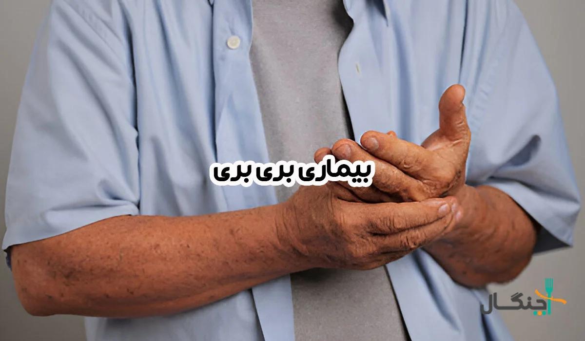 بیماری بری‌بری چیست؟ علائم، علت و درمان کمبود B1