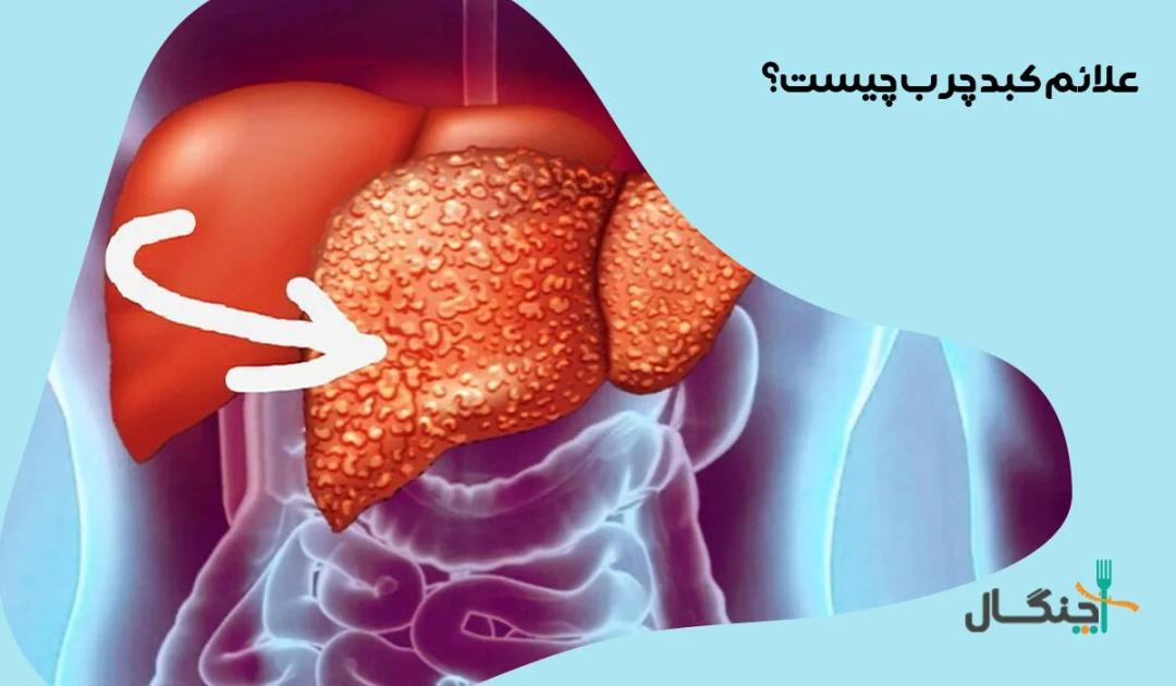 علائم کبد چرب چیست؟ علائم کبدچرب در زنان و مردان