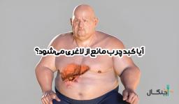 ایا کبد چرب مانع از لاغری میشود؟ پاسخ علمی به یک سوال پرتکرار